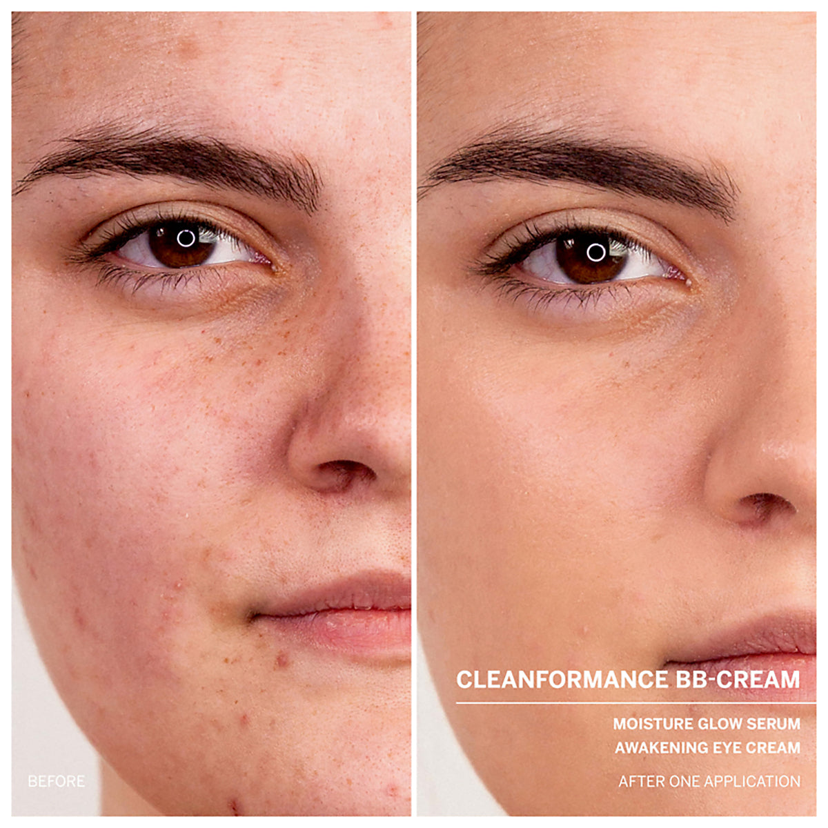 Microbiomic Awakening Eye Cream | 15 ml